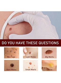 Body Wart Remove Pen
